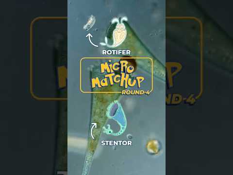 Who will win? Stentor vs Rotifer
